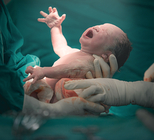 ניתוח קיסרי: כמה ניתוחים מותר?-תמונה